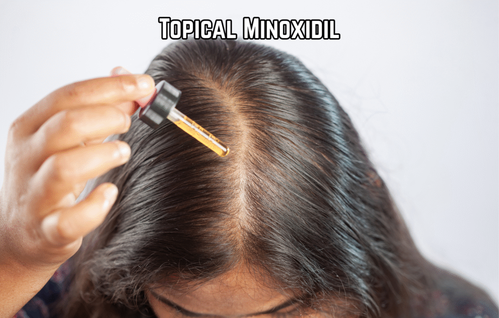 Is Hair Loss Reversible? Here’s What Dermatologists Say in 2025