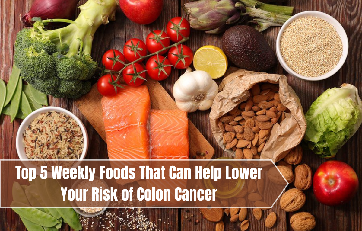 Top 5 Weekly Foods That Can Help Lower Your Risk of Colon Cancer