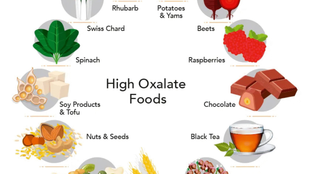 6 Foods to Avoid for Kidney Stone Prevention and What to Eat Instead