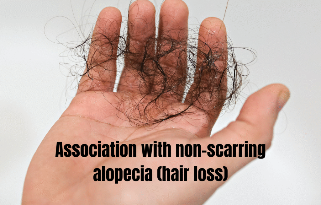 Vitamin D Deficiency and Hair Fall: What the Research Shows