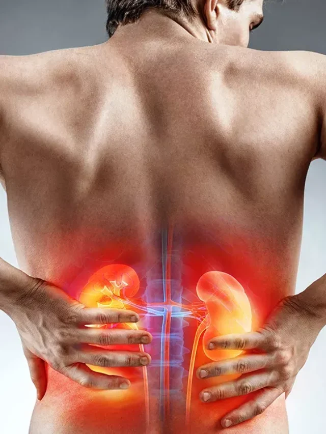 Kidney Disease Diet: Best Foods to Include Daily