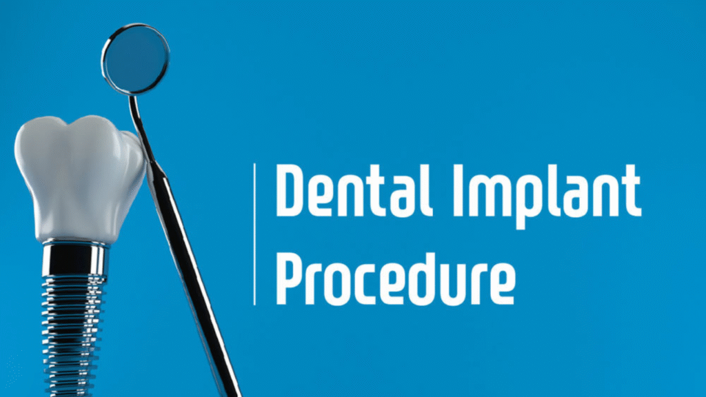 Affordable Dental Implants in the USA: Cost, Process, and Insurance Coverage