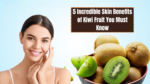 5 Incredible Skin Benefits of Kiwi Fruit You Must Know