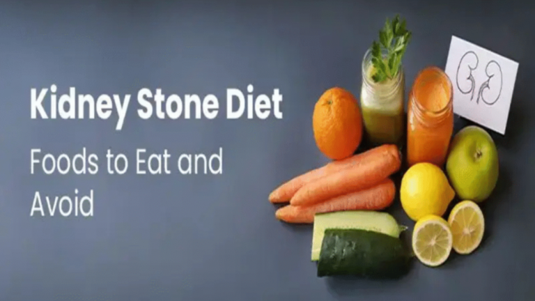 6 Foods to Avoid for Kidney Stone Prevention and What to Eat Instead