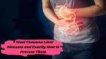 7 Most Common Liver Diseases and Exactly How to Prevent Them