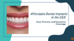 Affordable Dental Implants in the USA: Cost, Process, and Insurance Coverage
