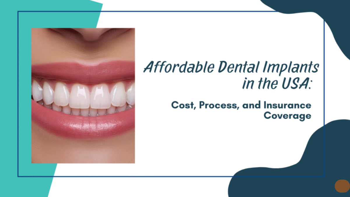 Affordable Dental Implants in the USA: Cost, Process, and Insurance Coverage