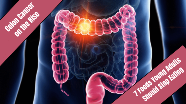 Colon Cancer on the Rise: 7 Foods Young Adults Should Stop Eating