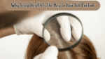Why Scalp Health Is the Key to Hair Fall Control
