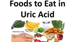 Control Uric Acid with These 7 Powerful Foods